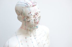 Acupuncture could serve as a drug-free pain reliever in emergency rooms